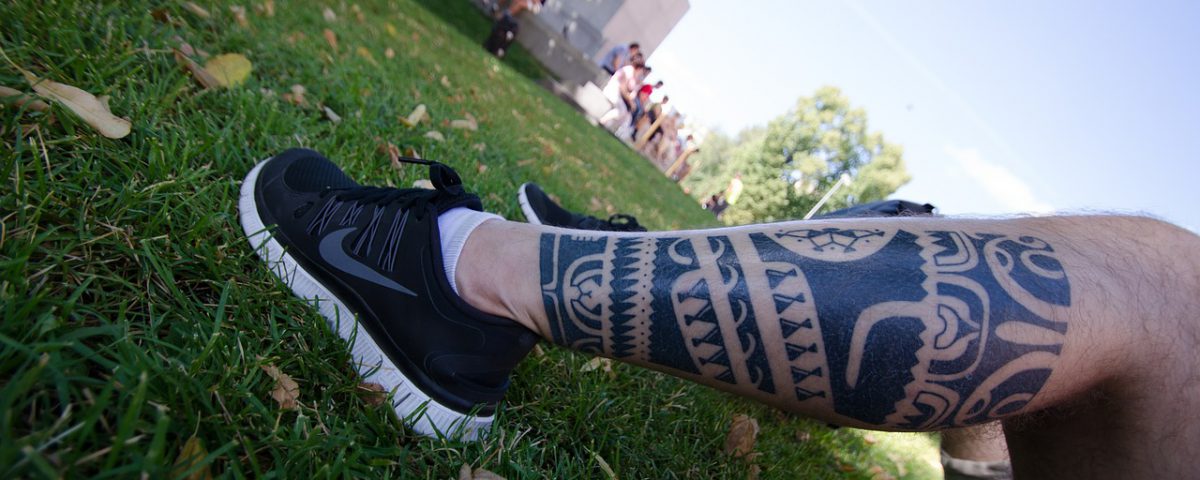 Enlèvement de tatouage