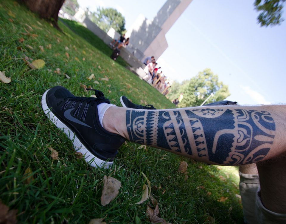 Enlèvement de tatouage