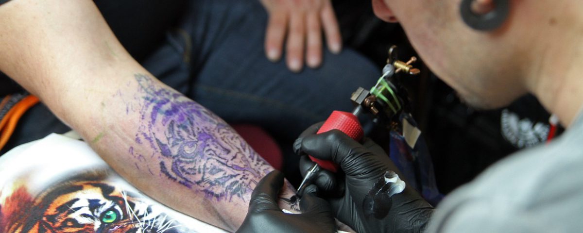 détatouage