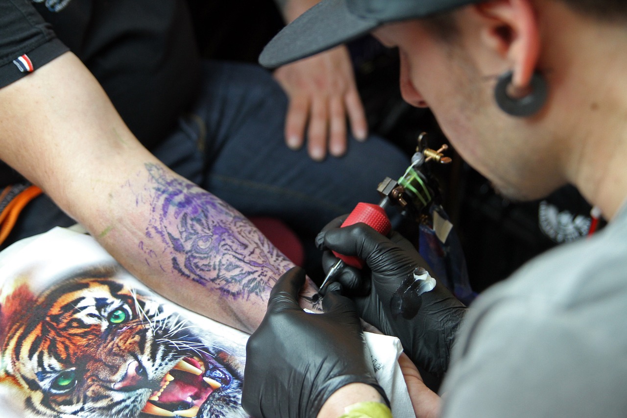 enlèvement de tatouage