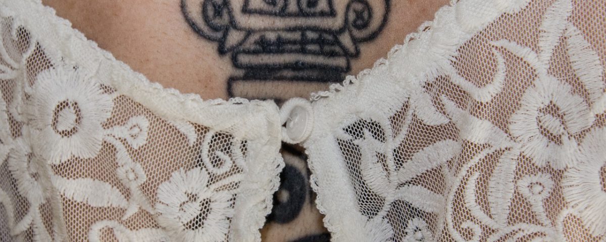 Enlèvement de tatouage