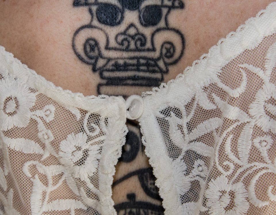 Enlèvement de tatouage