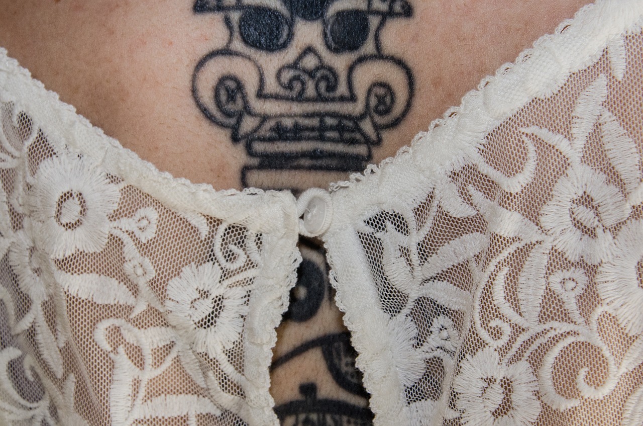 Enlèvement de tatouage