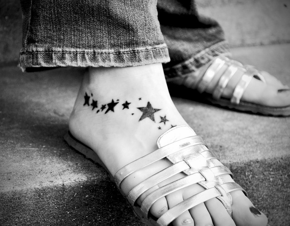 Enlèvement de tatouage
